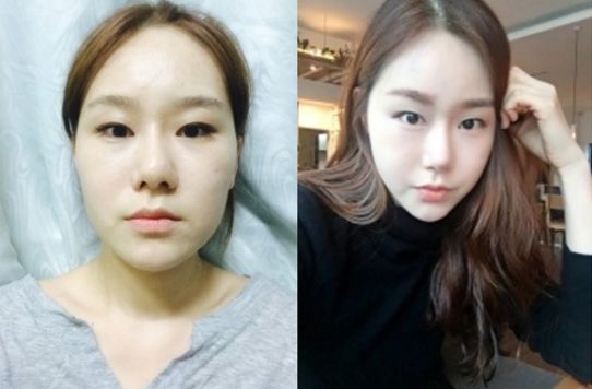 Mimi’s Plastic Surgery Real Review
