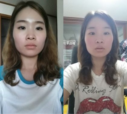 Hope’s Plastic Surgery Real Review