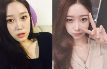 Hajung’s Plastic Surgery Real Review