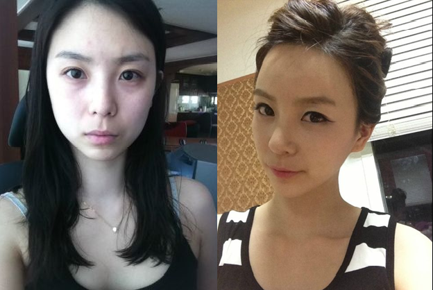 Beauty Girl’s Plastic Surgery Real Review