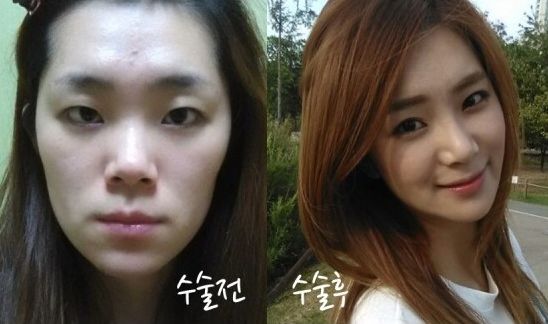 Ricky’s Plastic Surgery Real Review