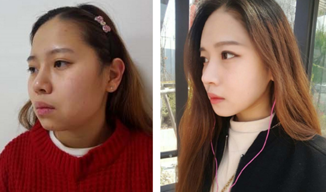 Yoni’s Plastic Surgery Real Review