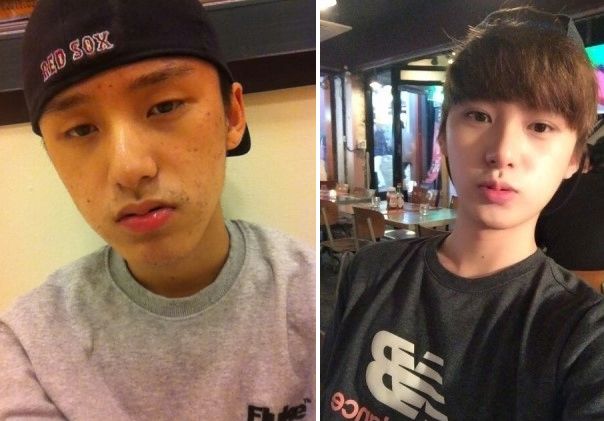 Hyun’s Plastic Surgery Real Review