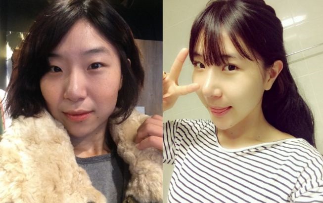 Moonie’s Plastic Surgery Real Review