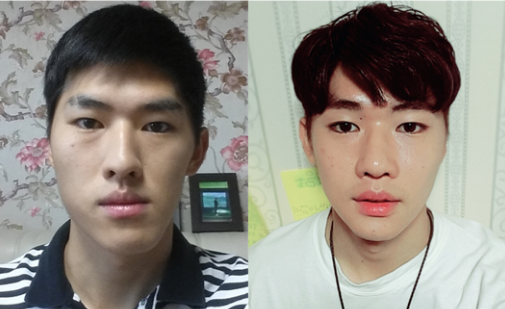 Mr.Yoo’s Plastic Surgery Real Review