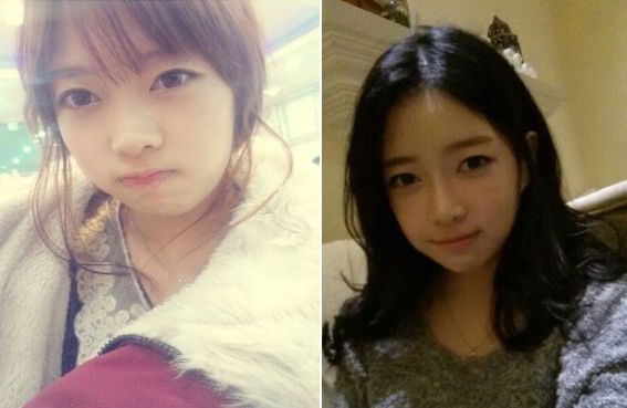 Hanbyul’s Plastic Surgery Real Review