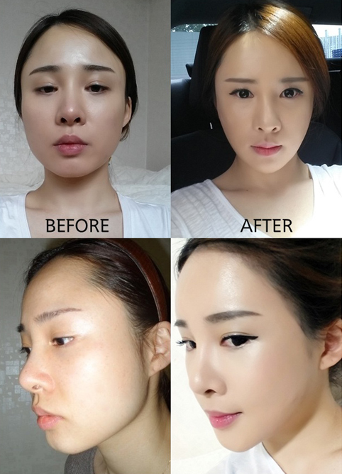 Chic Rabbit’s Plastic Surgery Real Review