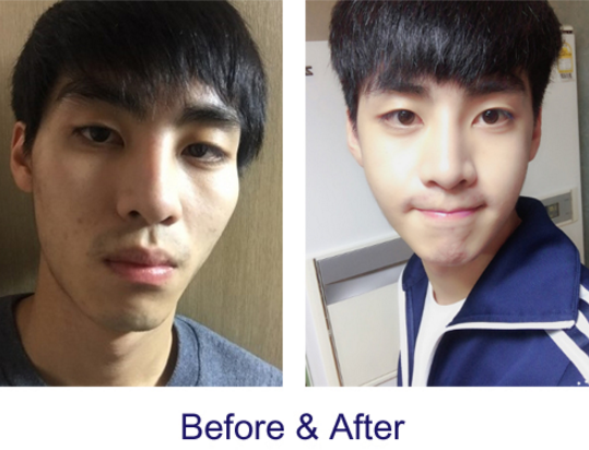 Mr. Choi’s Plastic Surgery Real Review
