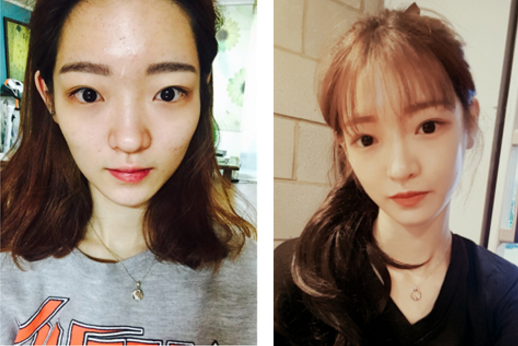 Dami’s Plastic Surgery Real Review