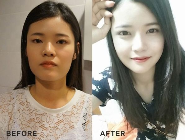 Deening’s Plastic Surgery Real Review