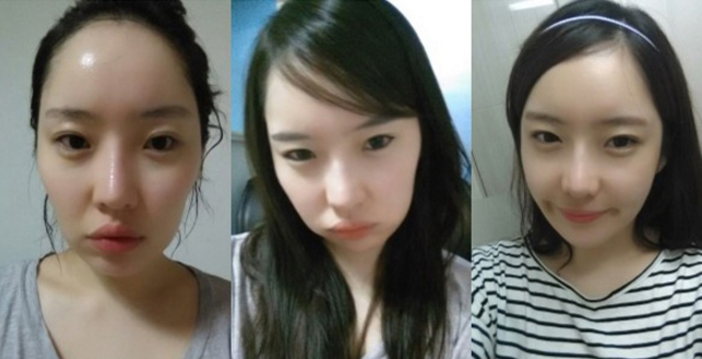 Dotori’s Plastic Surgery Real Review
