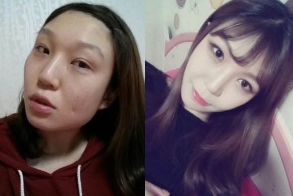 Flower’s Plastic Surgery Real Review