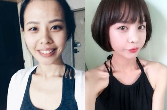 Hyerin’s Plastic Surgery Real Review