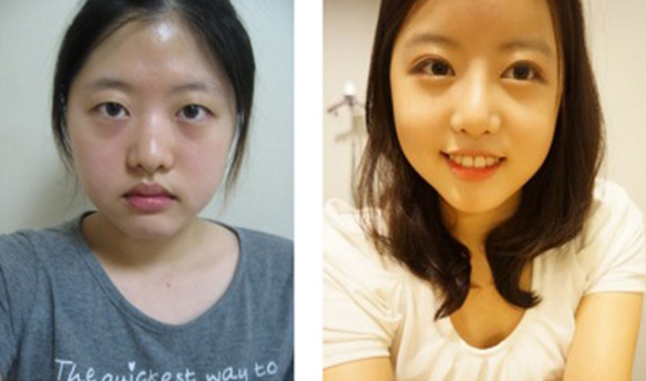 Irene’s Plastic Surgery Real Review