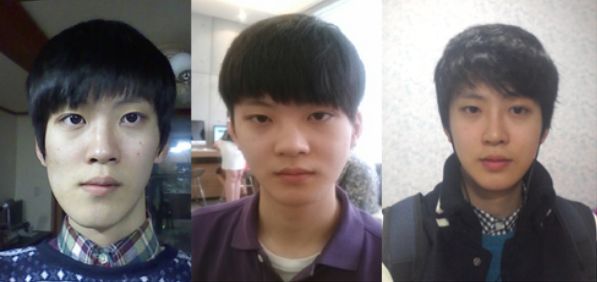 Jiho’s Plastic Surgery Real Review