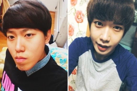 Jundori’s Two Jaw Surgery Real Review
