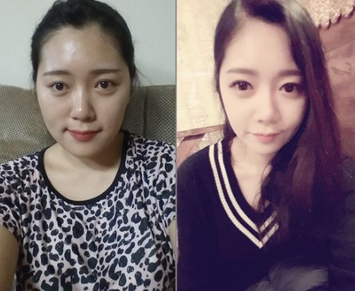 Latte’s Plastic Surgery Real Review