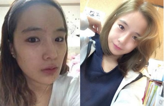 Misun’s Plastic Surgery Real Review