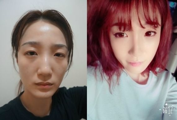 Pink Rabbit’s Plastic Surgery Real Review