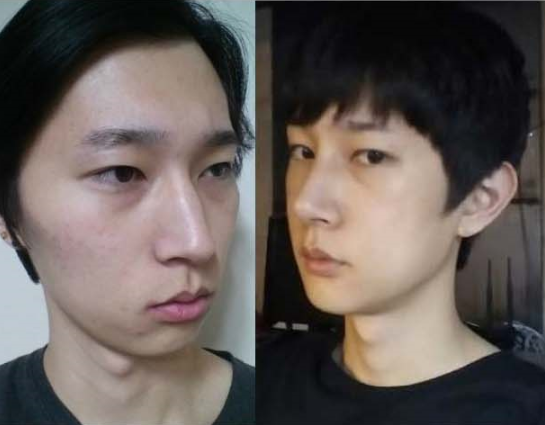 Rodi’s Plastic Surgery Real Review