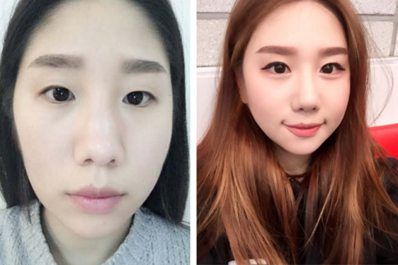 Shooding’s Plastic Surgery Real Review