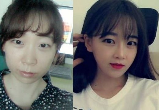 Sooni’s Plastic Surgery Real Review