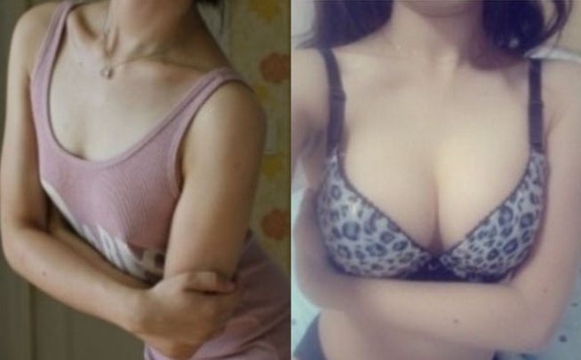 Chubby Honey’s Plastic Surgery Real Review