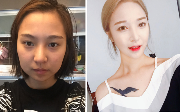 Cherin’s Plastic Surgery Real Review
