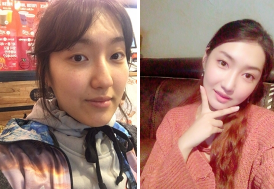 Daong’s Plastic Surgery Real Review