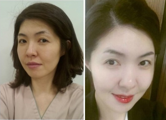 Cindy’s Plastic Surgery Real Review