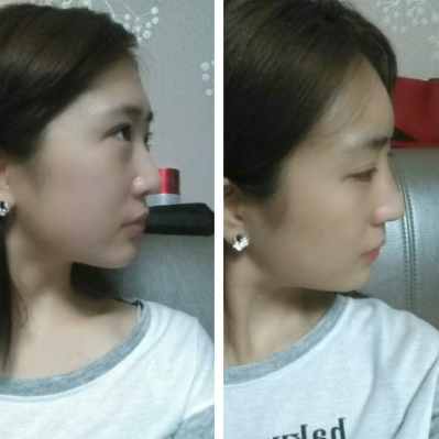 Kosooni’s Plastic Surgery Real Review