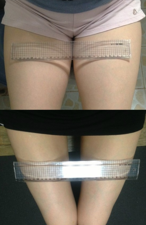 Pairi’s Plastic Surgery Real Review