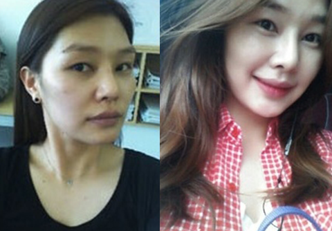 Gommy’s Plastic Surgery Real Review