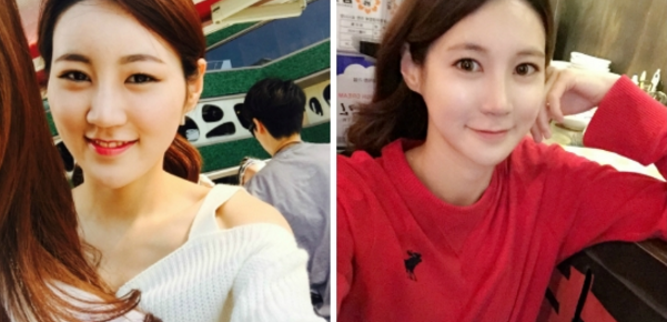 Namdong’s Plastic Surgery Real Review
