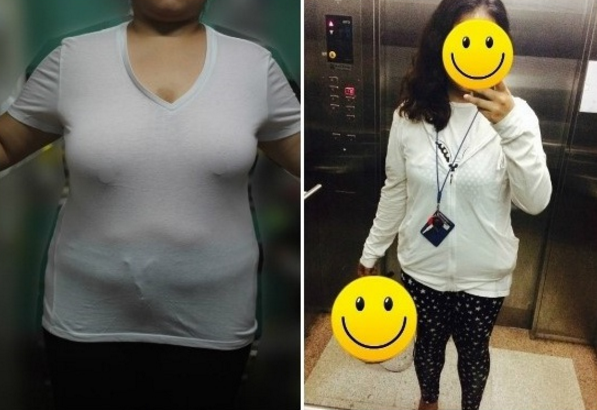 Purry’s Plastic Surgery Real Review