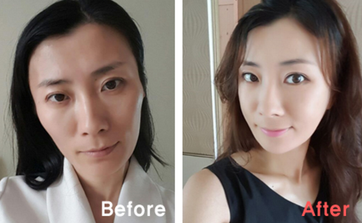 Mary’s Plastic Surgery Real Review
