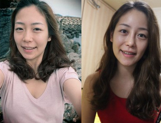 NaNa’s Plastic Surgery Real Review