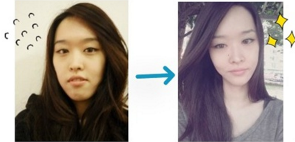 Yeondoo’s Plastic Surgery Real Review