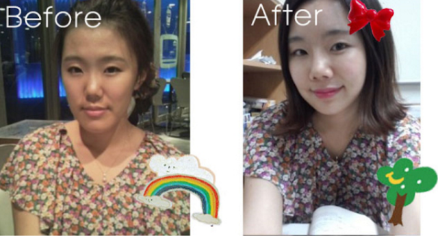 Wannabe’s Plastic Surgery Real Review