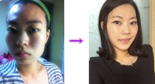 Lemon C’s Plastic Surgery Real Review