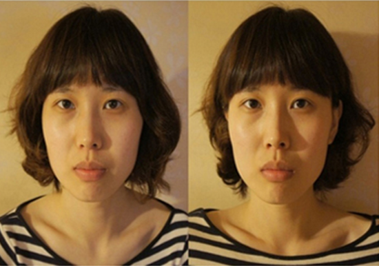 JY’s Plastic Surgery Real Review