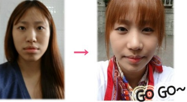 Ddani’s Plastic Surgery Real Review