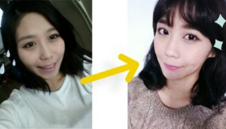 Selly’s Plastic Surgery Real Review