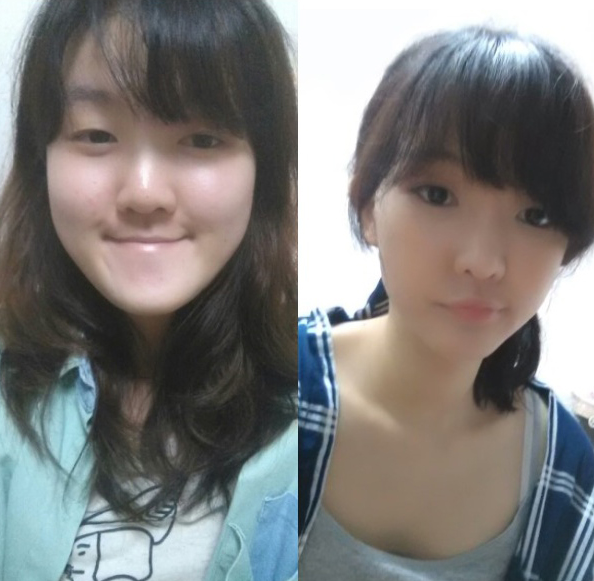 Banny Banny’s Plastic Surgery Real Review