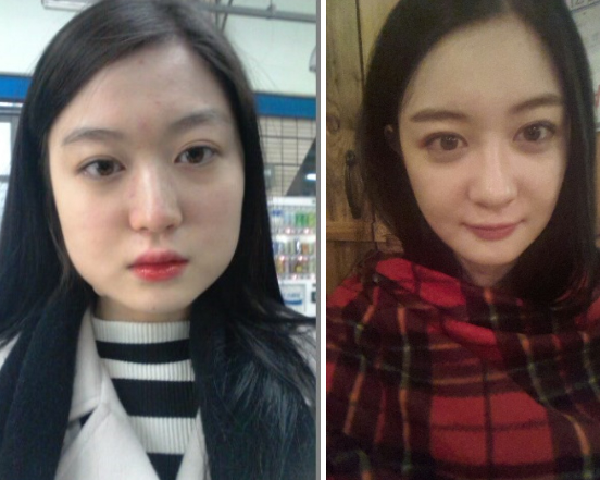 DDODDI’s Plastic Surgery Real Review