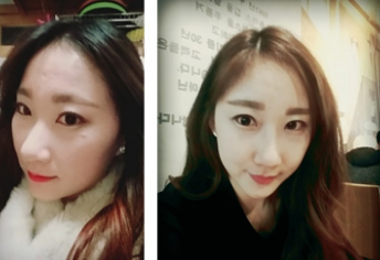 Ms.K’s Plastic Surgery Real Review