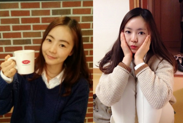 Twinkle Princess’s Plastic Surgery Real Review