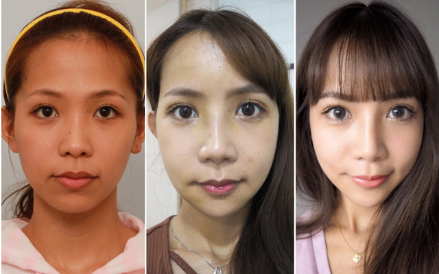 Chrissy’s Real Review of Plastic Sugery