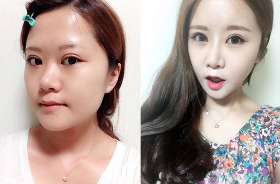 Simon’s Plastic Surgery Real Review
