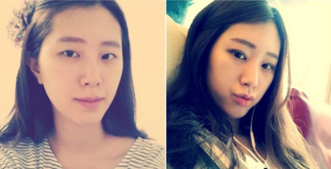 Ena’s Plastic Surgery Real Review